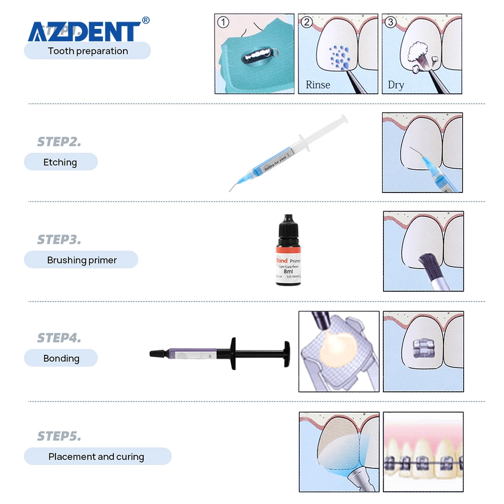 Dental Light Cured Orthodontic Bonding Resin Dental Orthodontic Materials